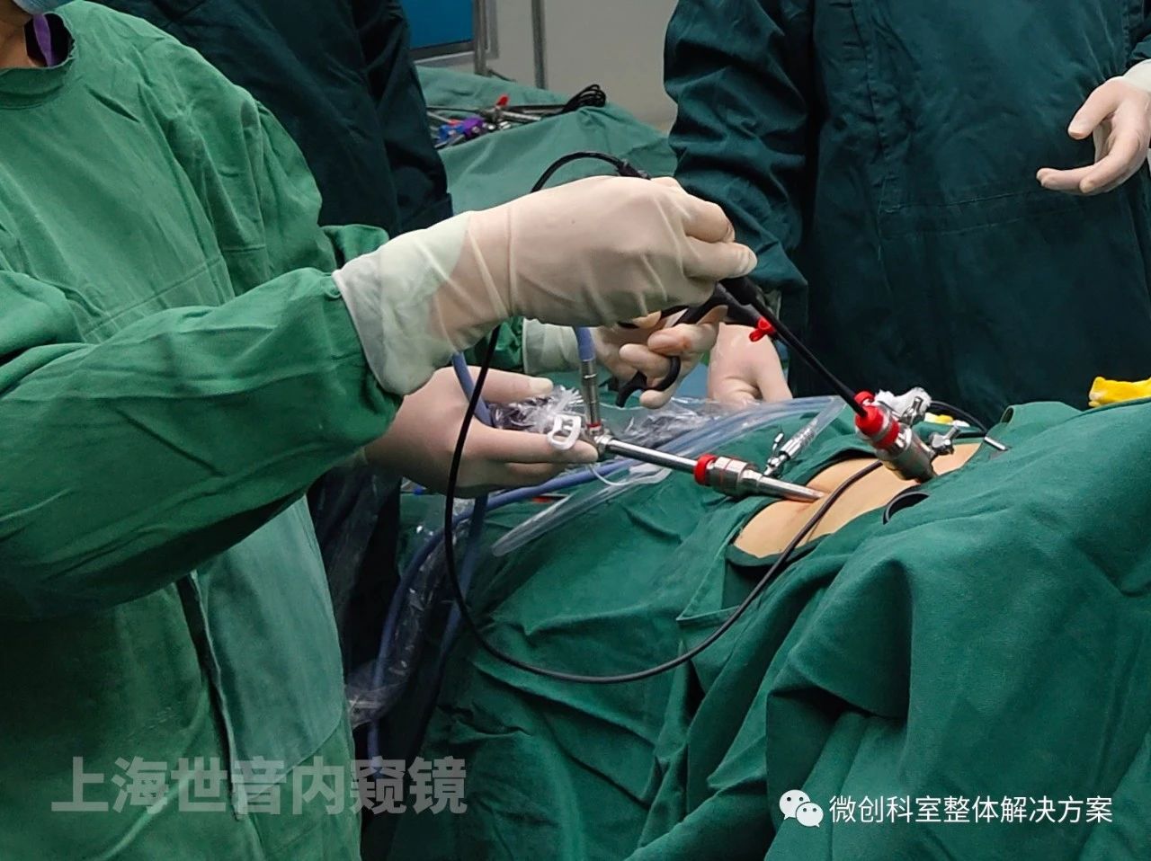 弄懂腹腔镜的视角原理是扶镜的基础,市面上一般有0°和30°两种镜头